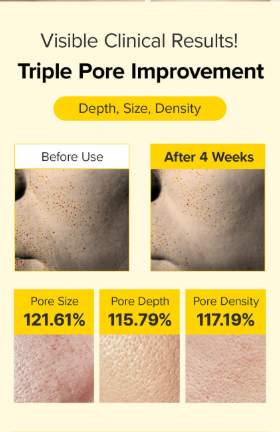 Mary & May Spicule Retinol PDRN Cream – Krém s retinolem, PDRN a mikrojehličkami 15ml (9)